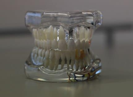 Chirurgien dentiste : tout savoir sur le rôle de votre prothésiste dentaire