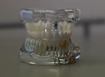 Chirurgien dentiste : tout savoir sur le rôle de votre prothésiste dentaire