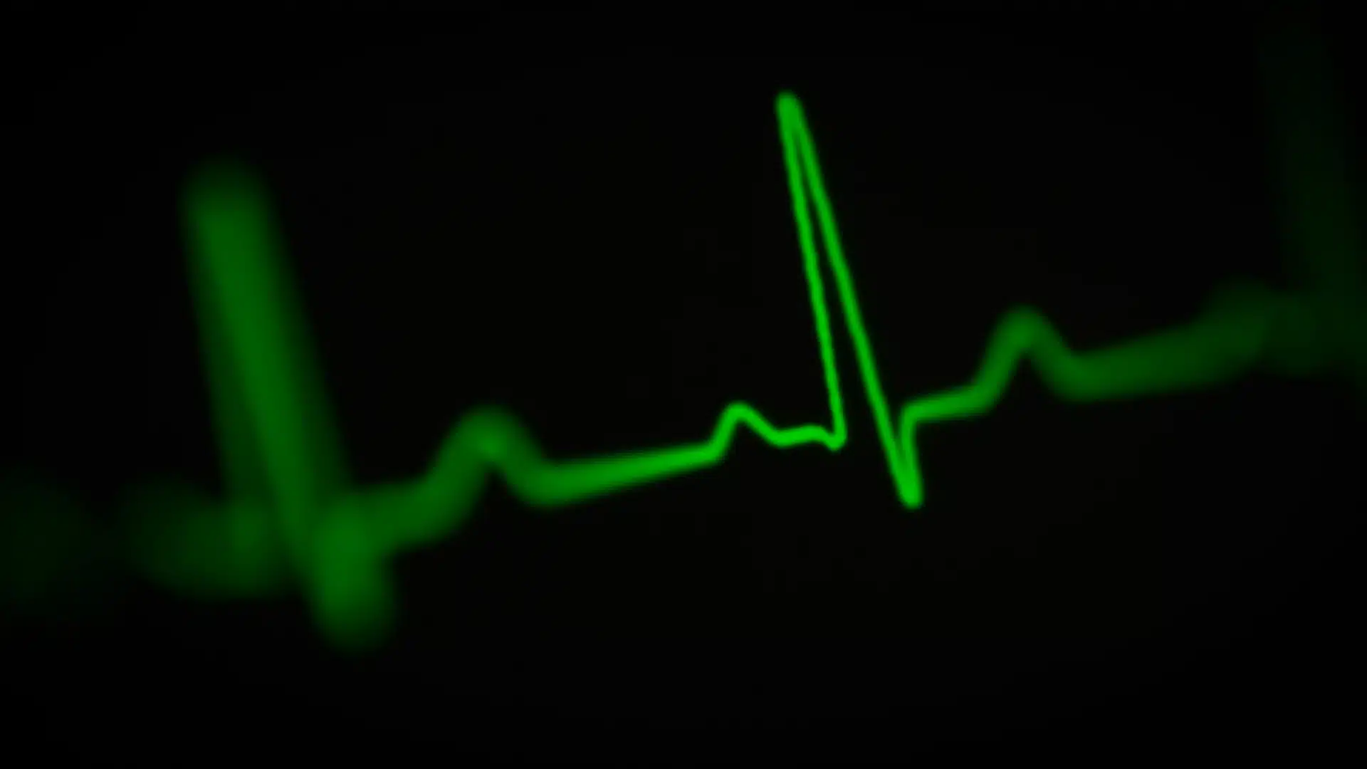 Optimisez votre pratique médicale avec la lecture à distance d'ECG
