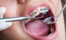 Trouver votre orthodontiste proche de la Suisse
