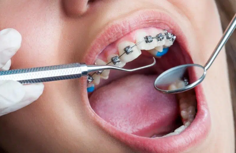 Trouver votre orthodontiste proche de la Suisse