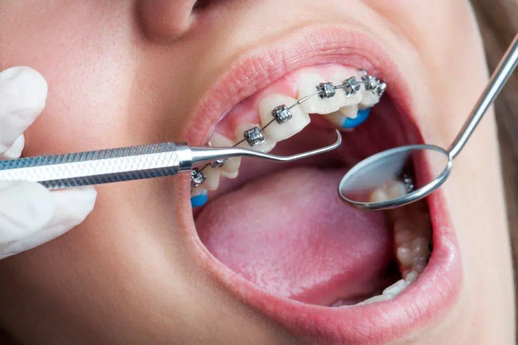 Trouver votre orthodontiste proche de la Suisse