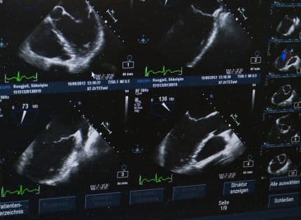 Quel suivi est réalisé chez la femme enceinte ?