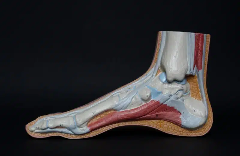 Arthrose vertébrale : prévention et traitement